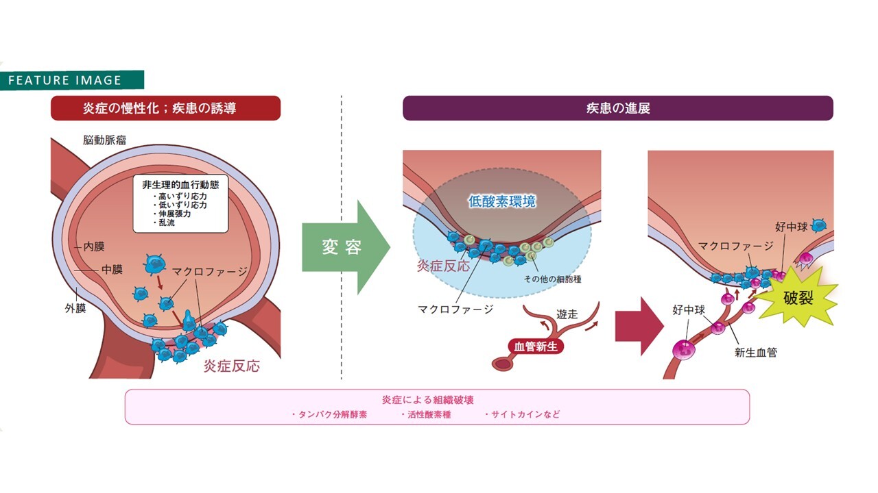 研究紹介のGraphical Abstract