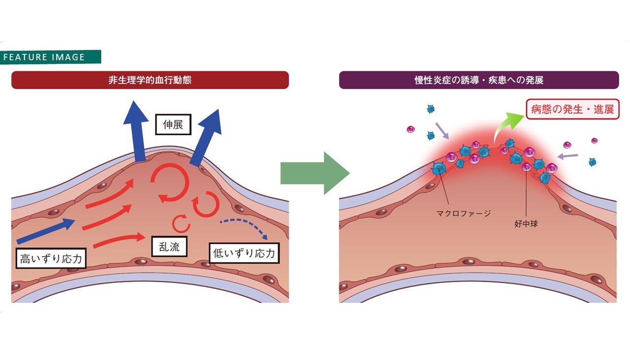 研究紹介Graphical Abstract