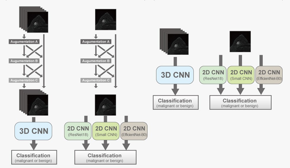 拡散強調MRIを解析するための人工知能（AI）アルゴリズム