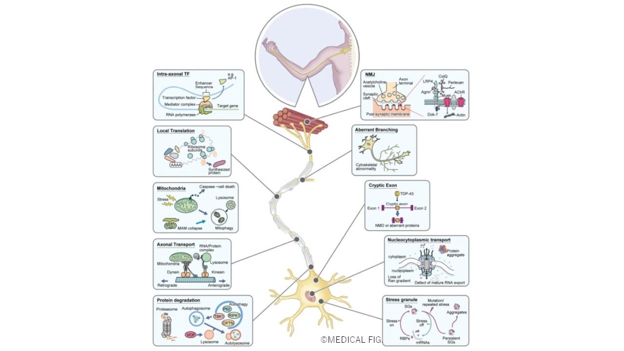 Overview of ALS pathology with a focus on axons. 