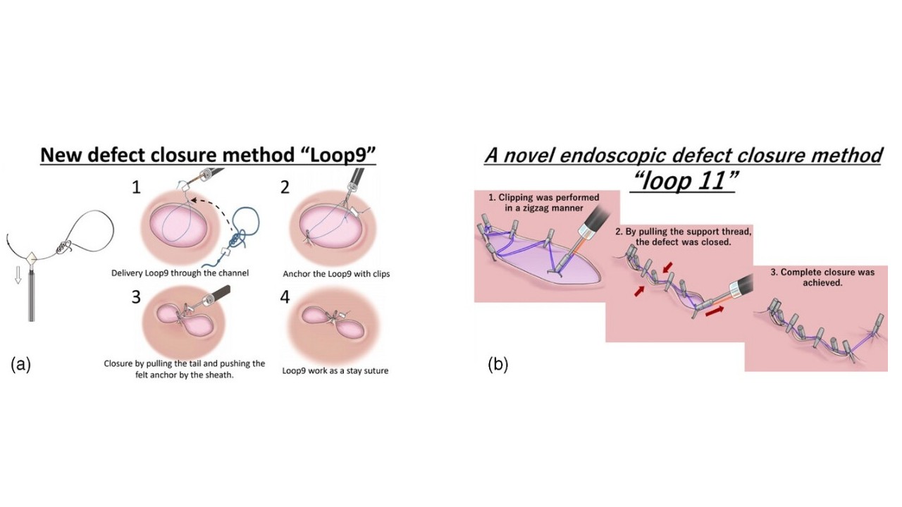 Schema of Loop9 and Loop1